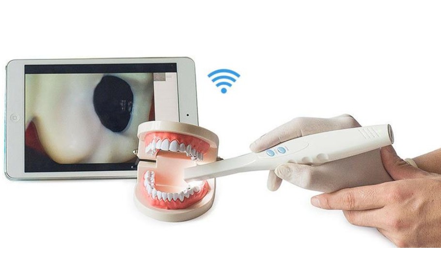 intra-oral-camera